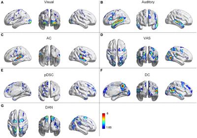 Mapping the time-varying functional brain networks in response to naturalistic movie stimuli